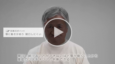 顎 重症 症例1