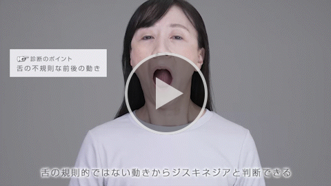 舌 軽症 症例3