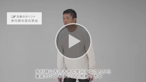 舌 重症 症例2