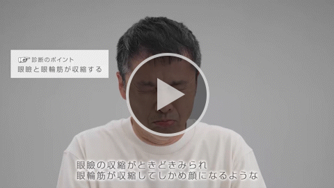 ジストニア1
