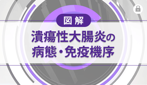 【図解】潰瘍性大腸炎の病態・免疫機序